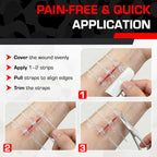Medizip Stitchless Zip Wound Closure Strip 60×70mm